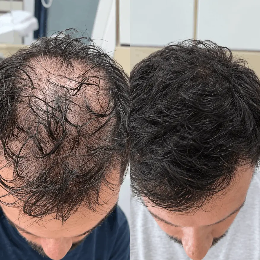 Hair reconstruction rsults (1)