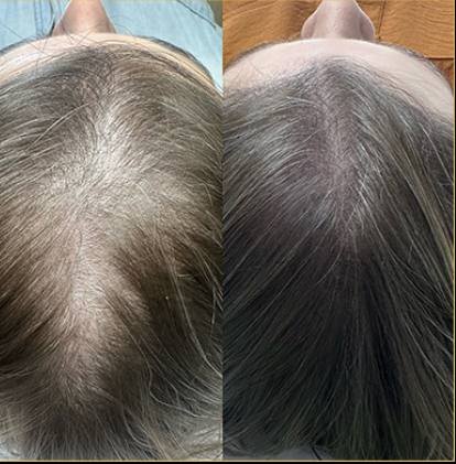 Hair reconstruction rsults (2)